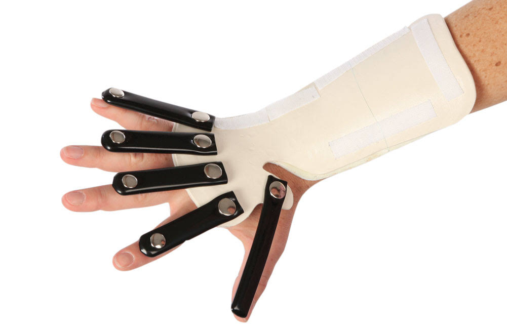 Radial Nerve Splint, Right, Extra Large Y393