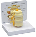 Basic Vertebrae Model A15335